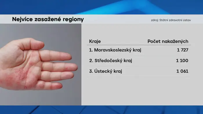 Nejvíce zasažené regiony