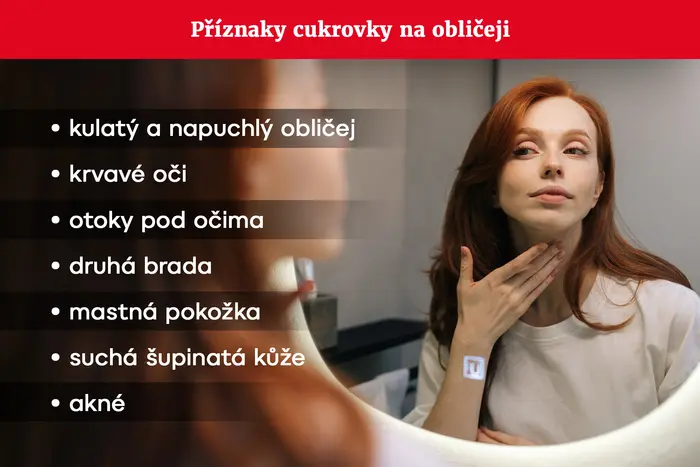 GRAFIKA Příznaky cukrovky na obličeji