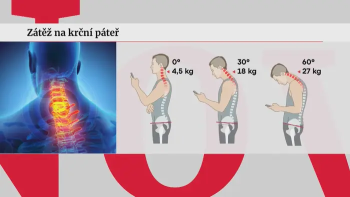 Zátěž na krční páteř