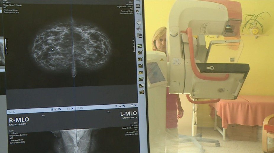 Na mamograf se ženy měly dostat i bez žádanky. Centra ji však stále vyžadují