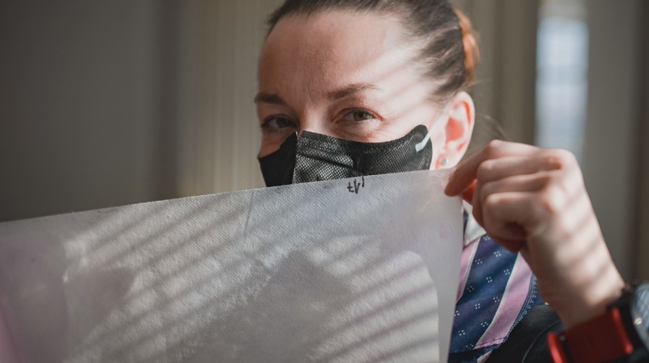 Na koronavirus, ale i popáleniny. Čeští vědci vyvinuli převratná vlákna