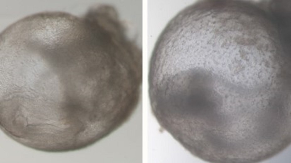 Přelom ve vědě. Výzkumníci vypěstovali první umělé embryo bez spermie i vajíčka