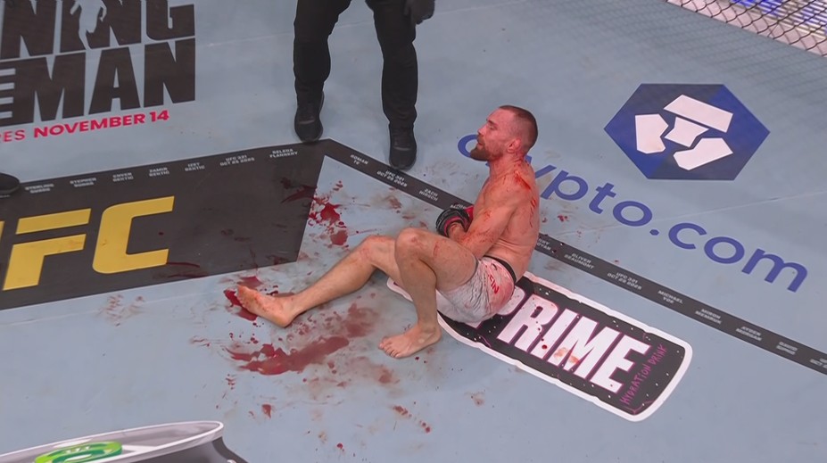 Klein dostal za heroický výkon v UFC finanční bonus! Popsal vážnost zlomeného kotníku