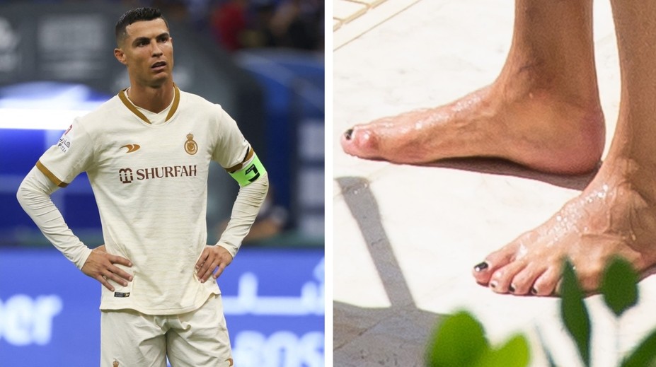 Proč si Ronaldo lakuje nehty na černo? Důvod je praktický