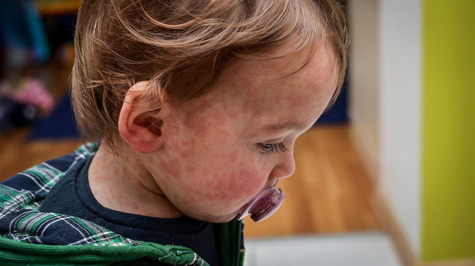 Evropou se šíří silně infekční nemoc. Nakazit vás může i člověk, který už v
místnosti není