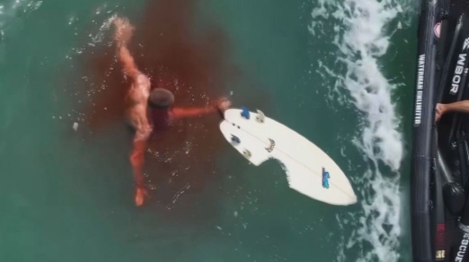 Surfař James Eastman sống sót sau vụ tấn công của cá mập