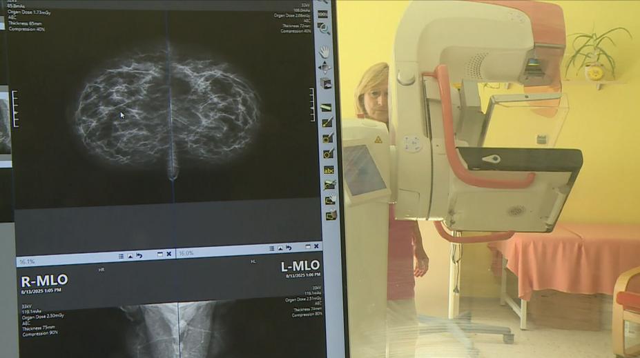 Na mamograf se ženy měly dostat i bez žádanky. Centra ji však stále vyžadují