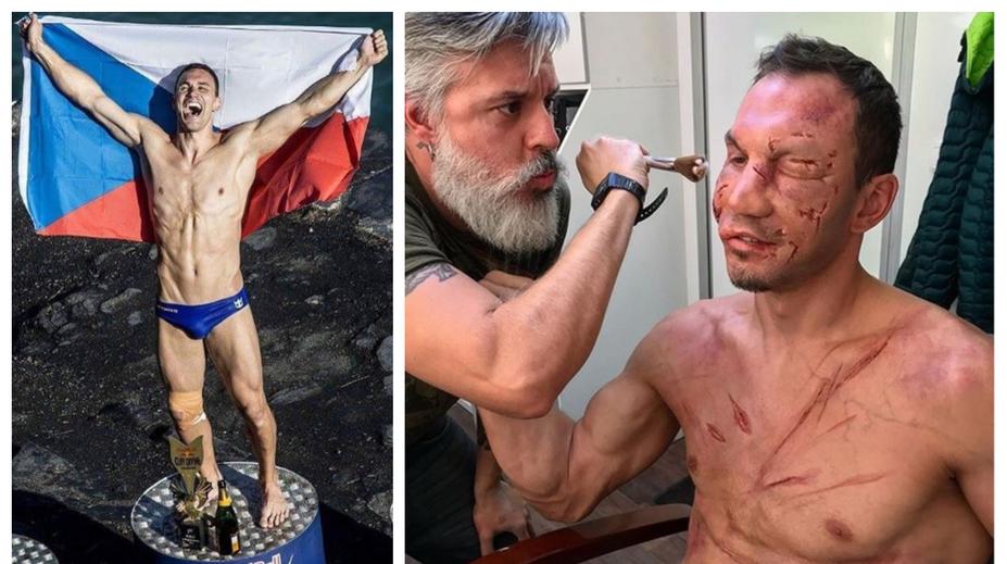 Děsivé šrámy a modřiny. Šampion ve skocích do vody vystrašil fanoušky