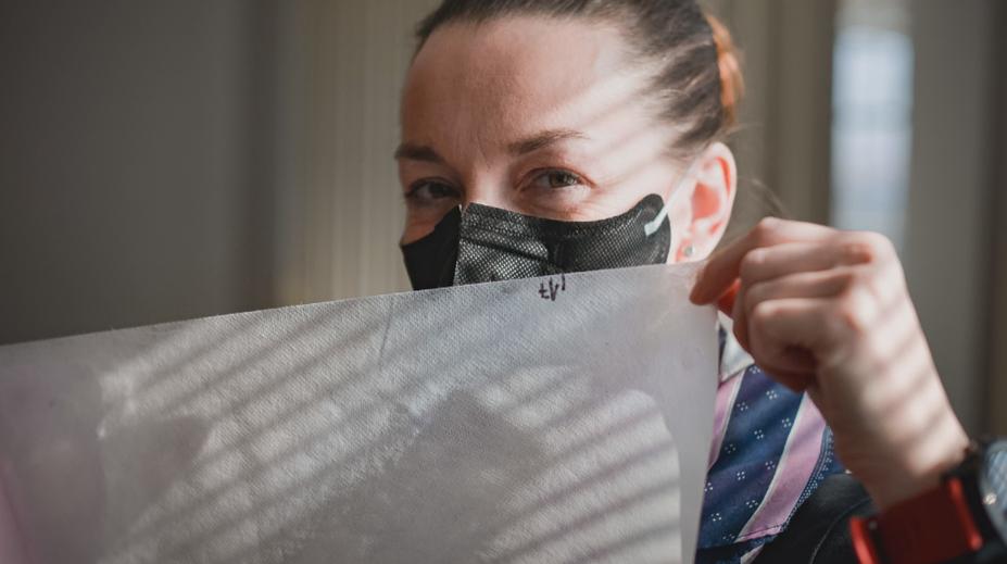 Na koronavirus, ale i popáleniny. Čeští vědci vyvinuli převratná vlákna