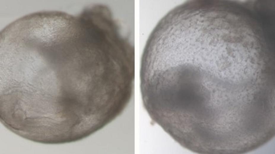 Přelom ve vědě. Výzkumníci vypěstovali první umělé embryo bez spermie i vajíčka