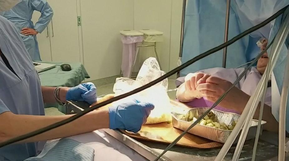 60letá žena z Itálie během skoro tříhodinové operace mozku plnila olivy