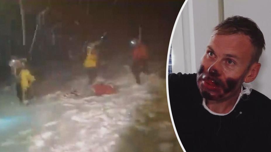 Při výstupu na Elbrus zemřelo pět horolezců. Další ukázali děsivá zranění