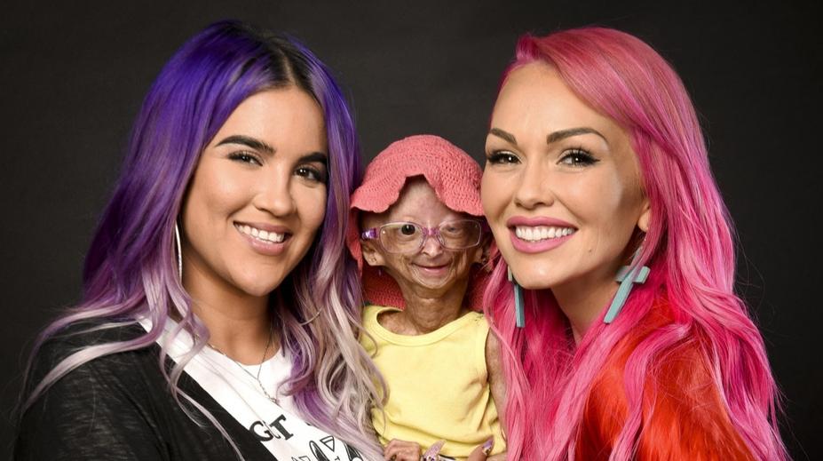 Už v mládí vypadala jako stařenka. Dívka, která stárla osmkrát rychleji, zemřela