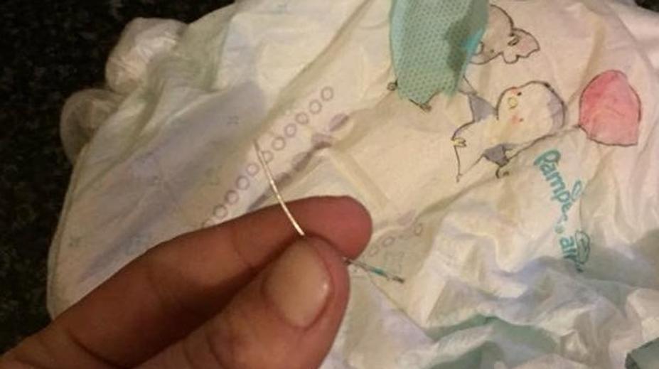 Šokující nález! Maminka našla v plence dvouletého syna jehlu