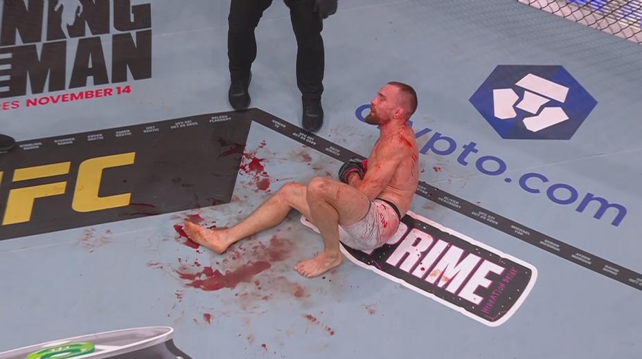 Klein dostal za heroický výkon v UFC finanční bonus! Popsal vážnost zlomeného kotníku