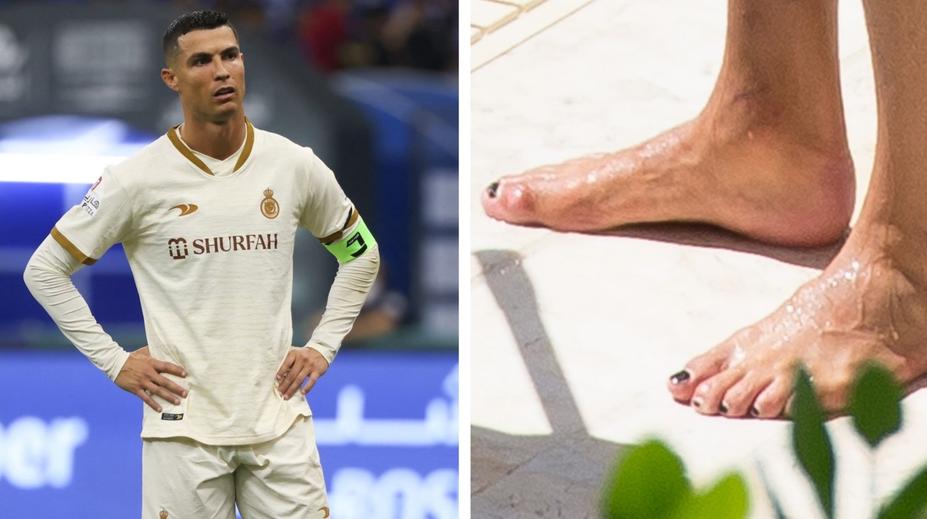 Proč si Ronaldo lakuje nehty na černo? Důvod je praktický