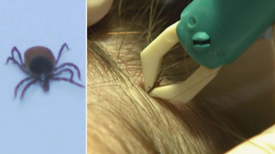 Klíšťat letos bude víc, i kvůli hrabošům. Můžete skončit i v kómatu