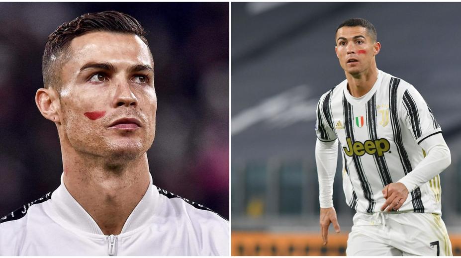 Tajemství červené skvrny na tváři Ronalda? Je to kampaň!