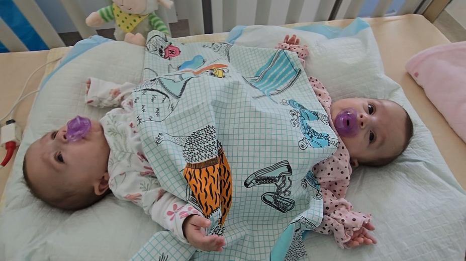 Lékaři jsou připraveni oddělit siamská dvojčata Aničku a Lucku. Má to ale háček