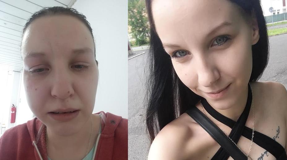 Hororový zubař v Teplicích! Žena má po zákroku zničené zuby i dásně
