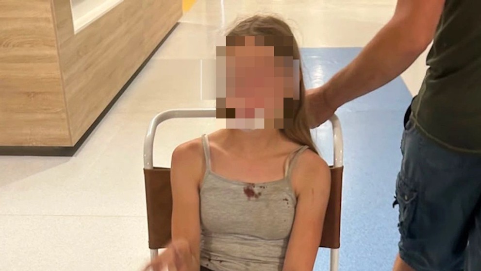 SUV s vozíkem poplašilo koně. Jeden musel být utracen, zranila se i dívenka