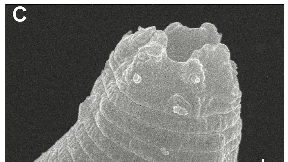 Oživené háďátko Panagrolaimus kolymaensis (3)