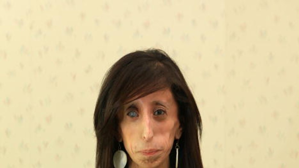 Lizzie Velasquezová - 5
