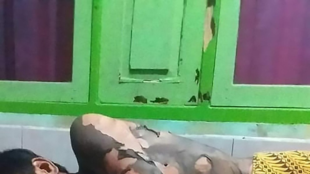 Manželka zapálila svého muže - 2