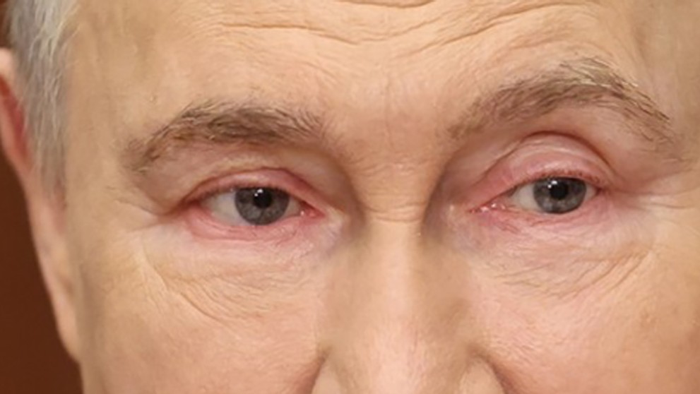 Vladimir Putin měl zarudlé oči