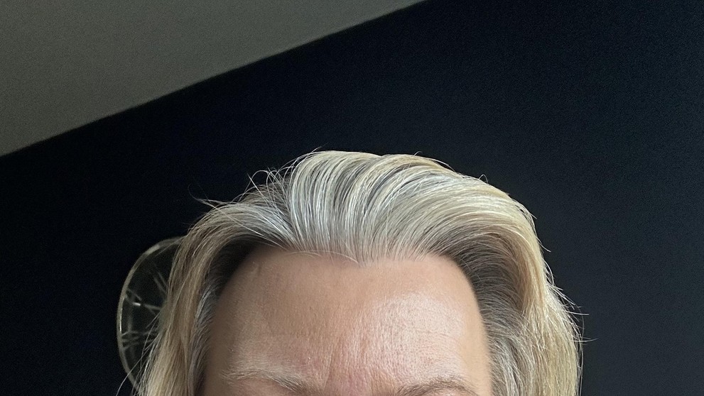 Prasklé aneurysma, operace