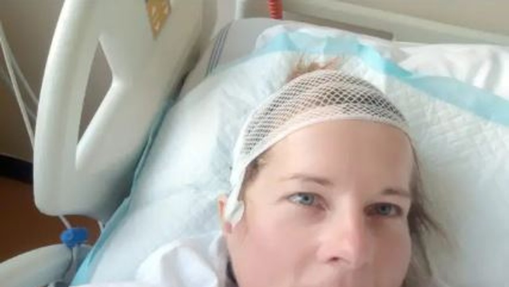 Renatě našli lékaři agresivní nádor na mozku