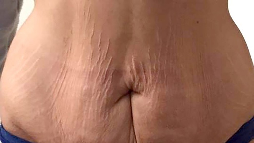 Mladá Britka Amber Rose zhubla 83 kilo - 4