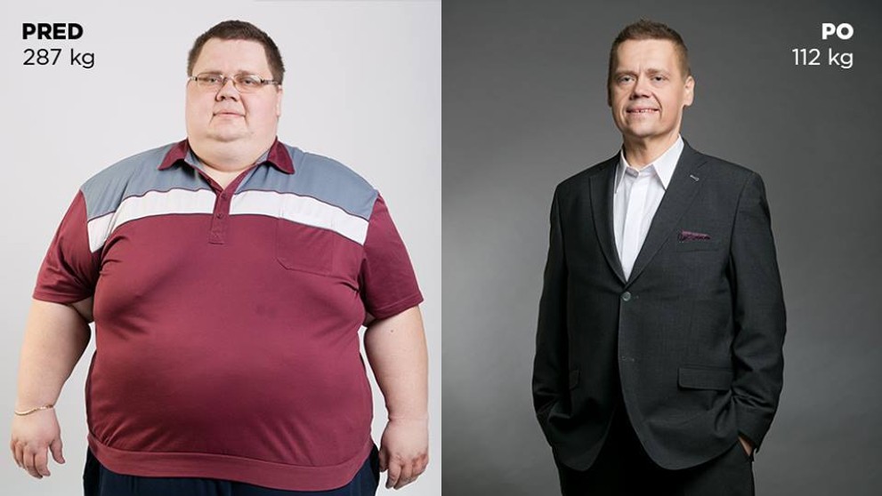 Slovák Ján zhubl za rok 175 kilo - 3