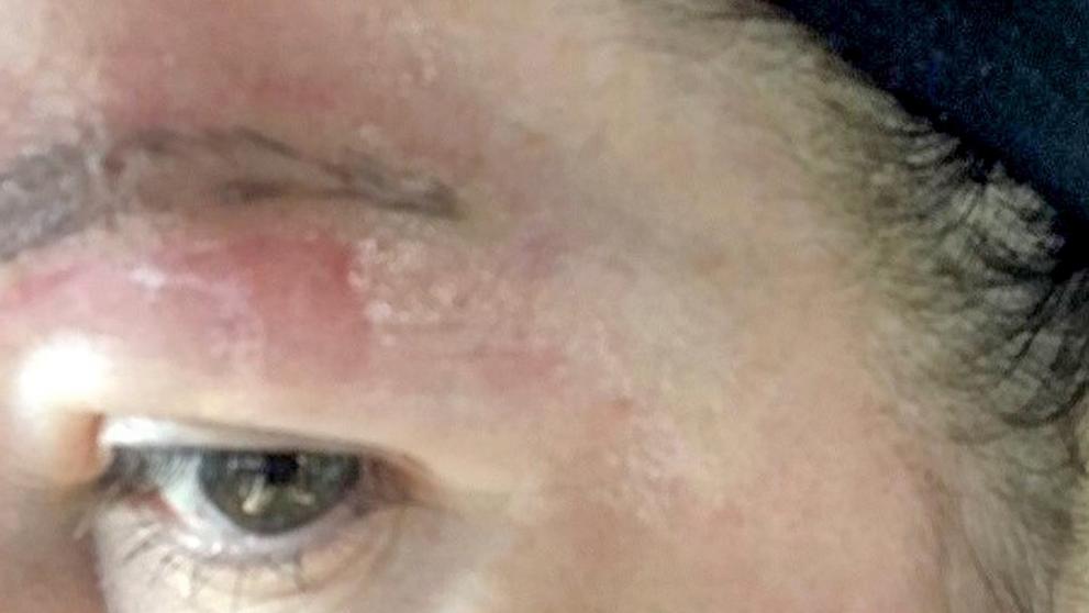 Žena si nechala vytetovat obočí. Poté si prošla peklem - 3