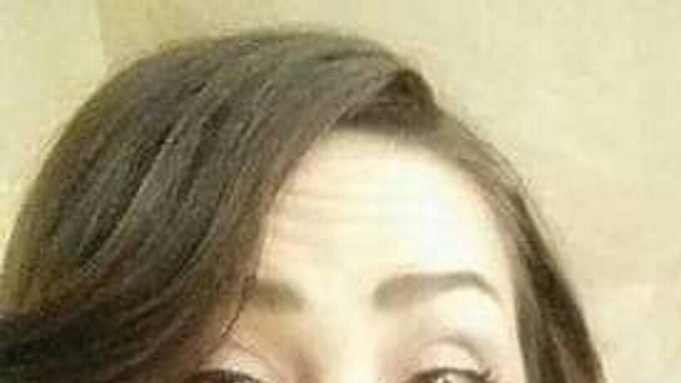 Ženě způsobila barva na vlasy alergickou reakci - 2