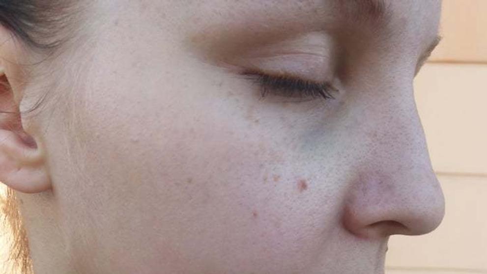 Špatná zkušenost se zubařem v Teplicích - 3