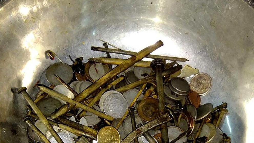 Muž měl v žaludku několik kilogramů železa