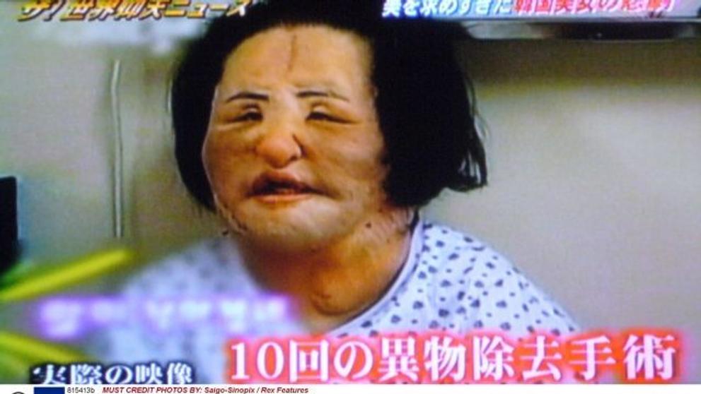 Hang Mioku - 1