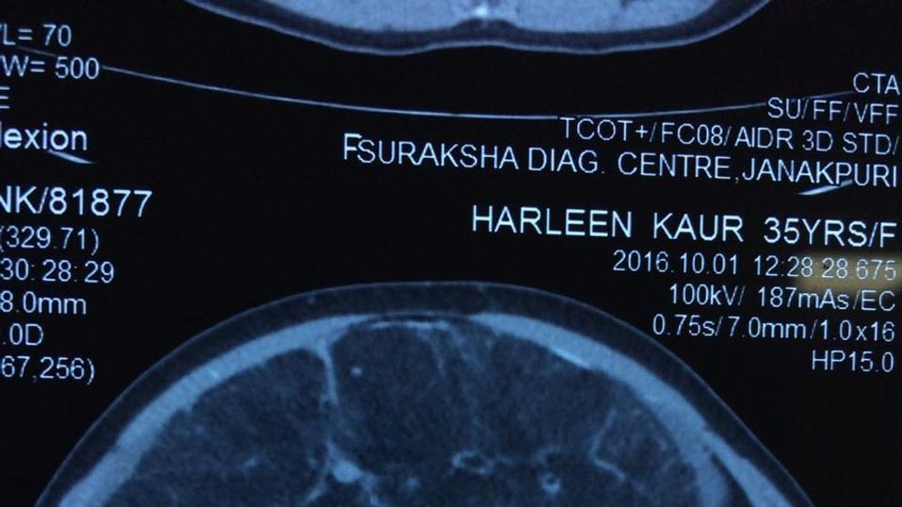 Ženě odstranili nádor vážící 7kg - 2