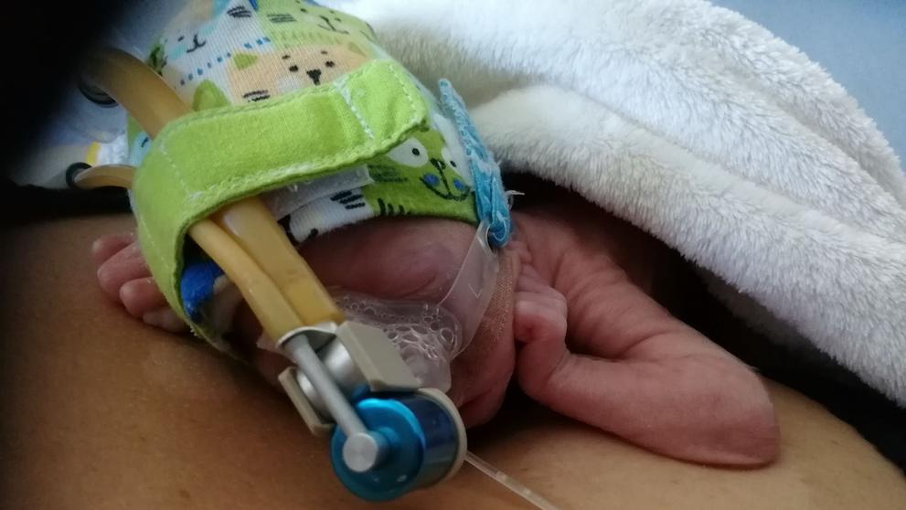 Jituška po porodu vážila 650 gramů