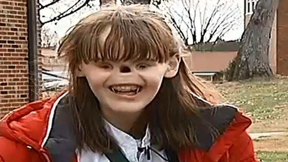 Cassidy Hooper - bez očí a nosu - 5