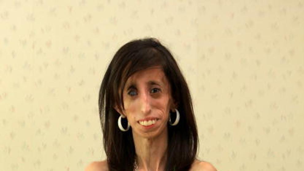 Lizzie Velasquezová - 6