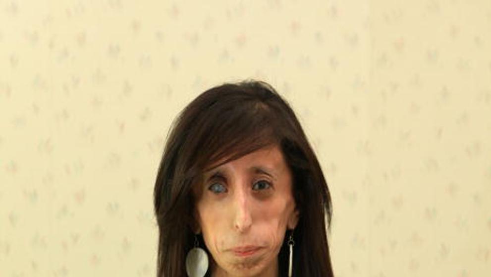 Lizzie Velasquezová - 5