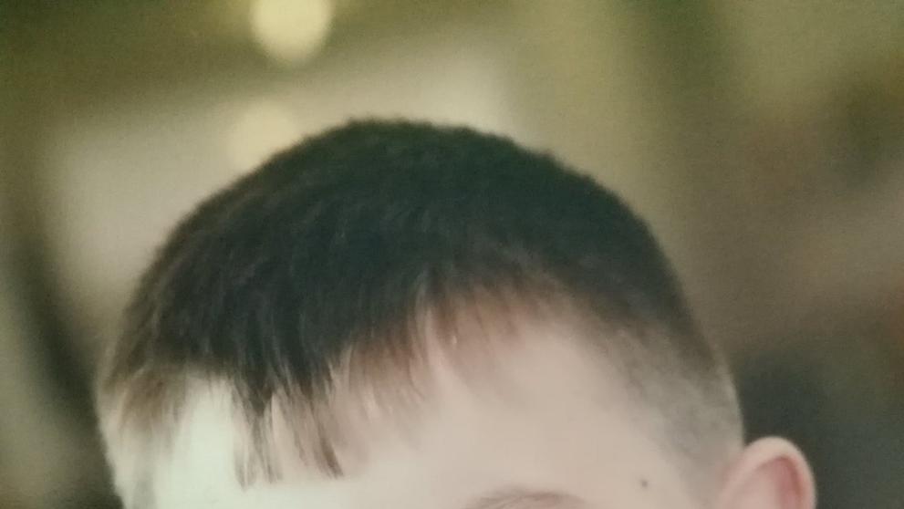 Adam má poškozený mozek - 8