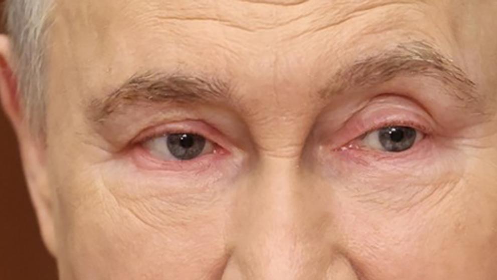 Vladimir Putin měl zarudlé oči