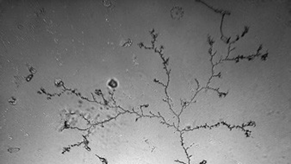 Slzy pod mikroskopem - slzy radosti