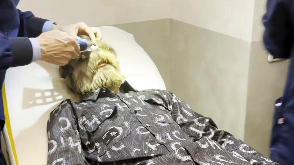 Indický teenager s nejchlupatějším obličejem se dostal do Guinnessovy knihy rekordů (1)