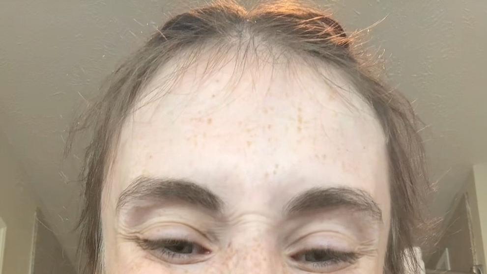 Žena přišla kvůli nedostatku vitamínů o všechny zuby