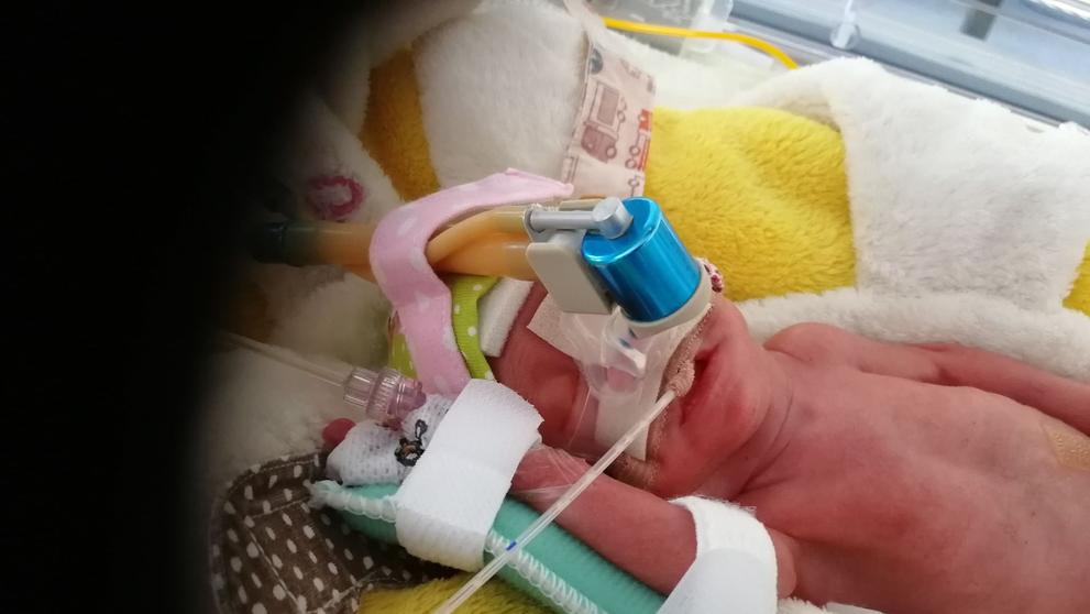 Jituška po porodu vážila 650 gramů