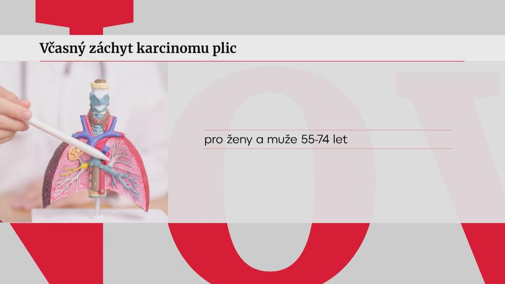 Včasný záchyt karcinomu plic